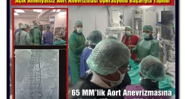 Tarsus Devlet Hastanesinde Bir İlk Daha Açık Ameliyatsız Aort Anevrizması Operasyonu Başarıyla Yapıldı