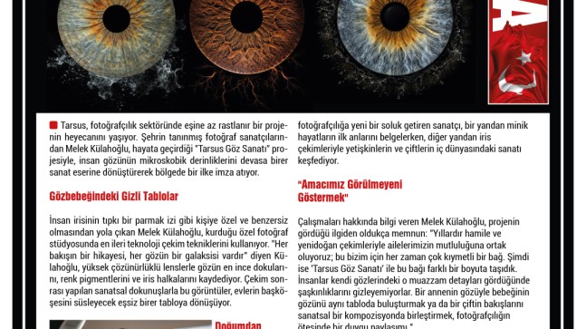 Gözlerin Gizemli Dünyası “Tarsus Göz Sanatı” ile Aralanıyor!