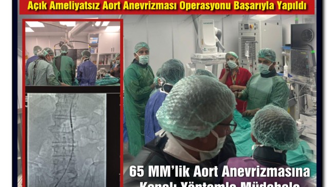 Tarsus Devlet Hastanesinde Bir İlk Daha Açık Ameliyatsız Aort Anevrizması Operasyonu Başarıyla Yapıldı